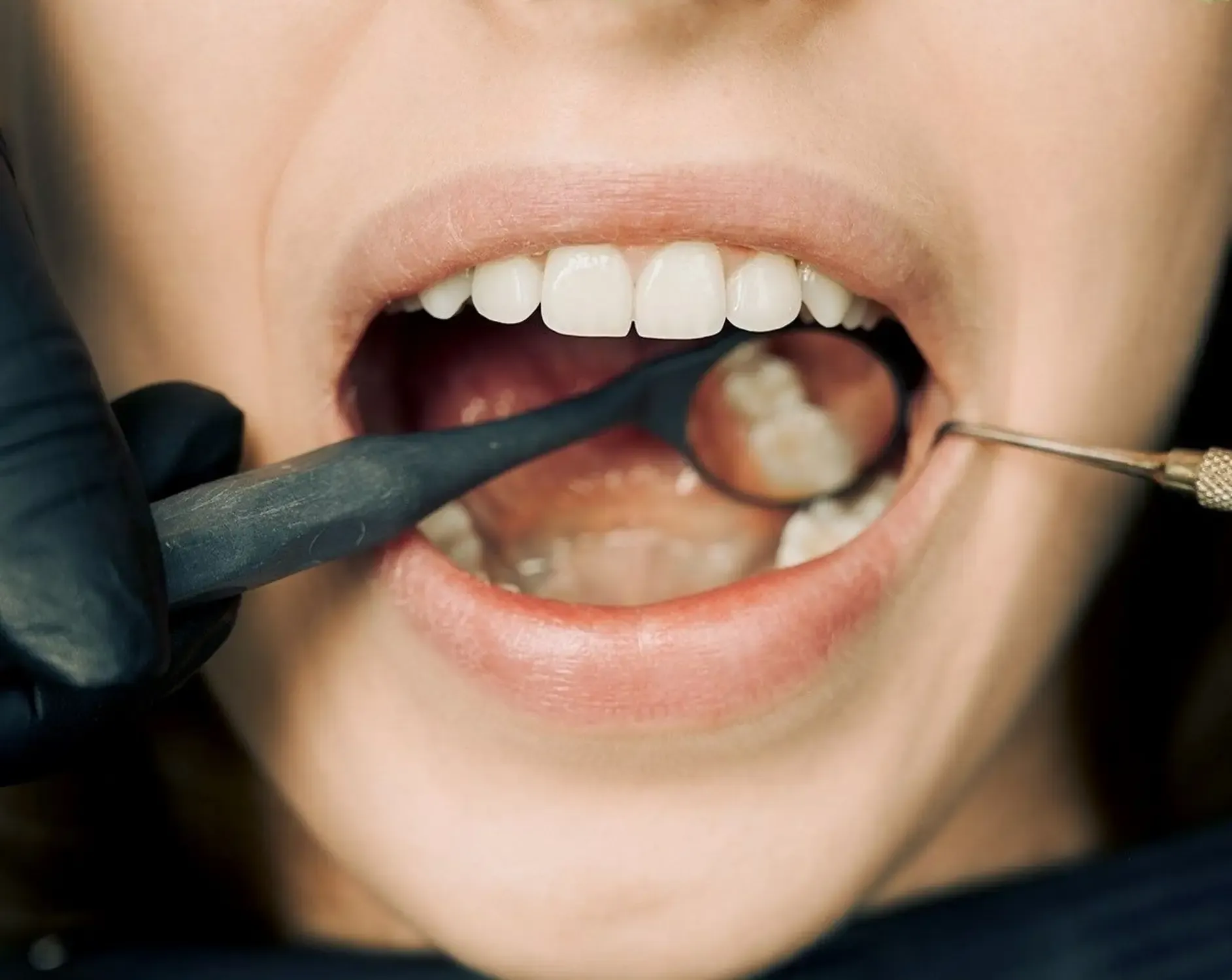 What Does a Healthy Mouth Look Like?