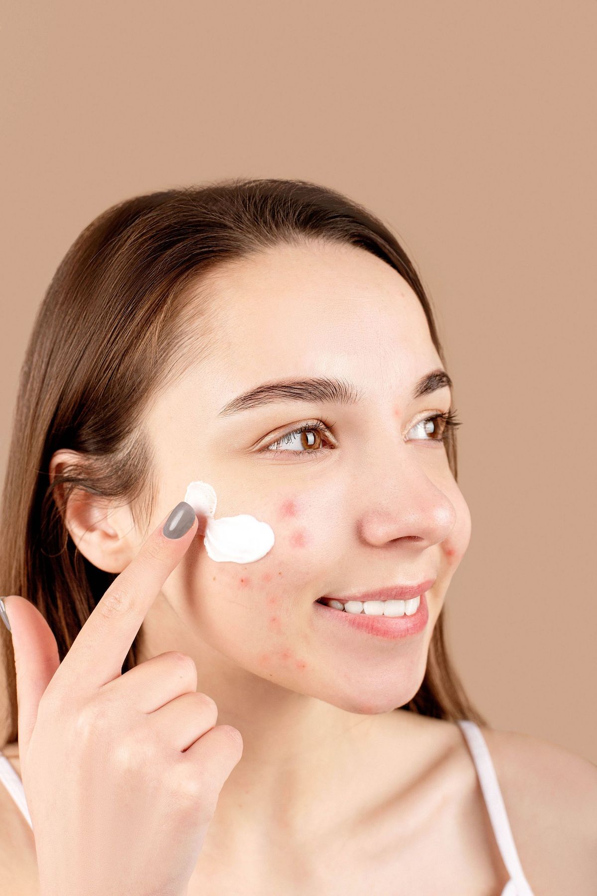 What's The Best Probiotic for Acne? We'll Tell You!
