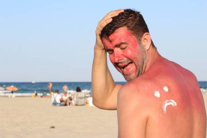 Best Sunscreen for Eczema